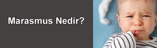 Marasmus Nedir? Nasl Tedavi Edilir?