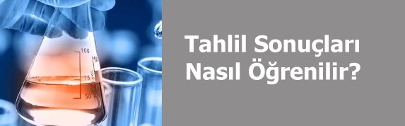 Tahlil sonular nasl renilir?